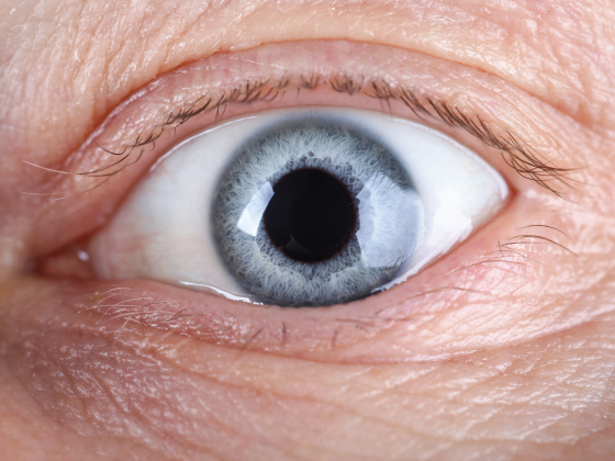 cataract-surgeries