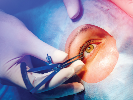 Corneal Infection Treatments